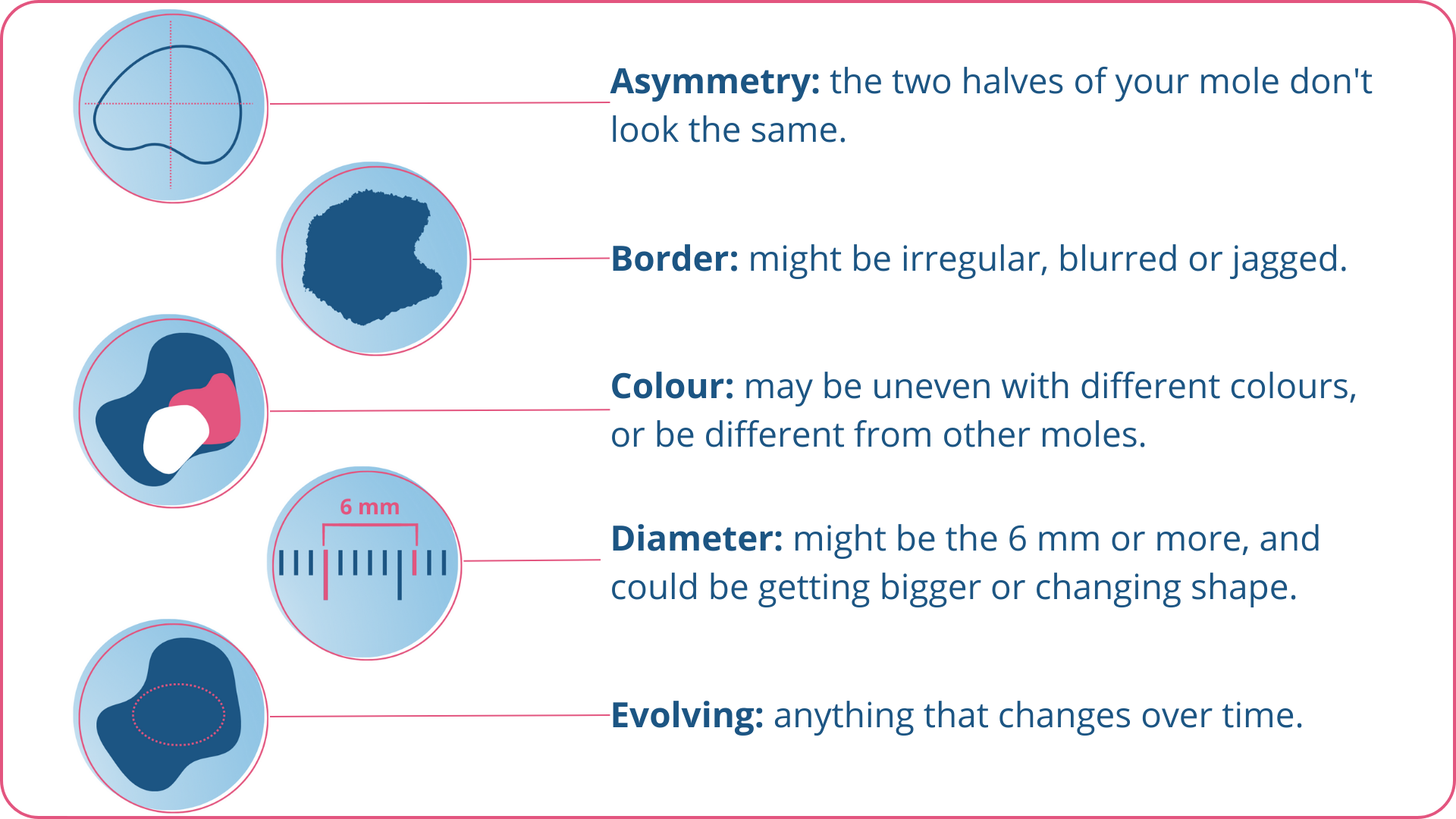 Check your moles ABCDE