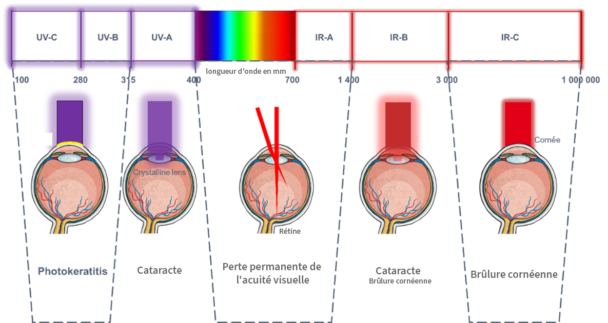 An image of the types of eye damage caused by different wavelengths of laser. Listed above.